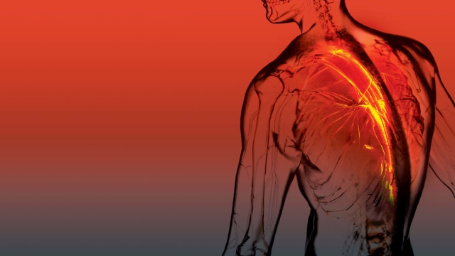 Igniting Relief: Mastering Pain Management for Low Back Pain