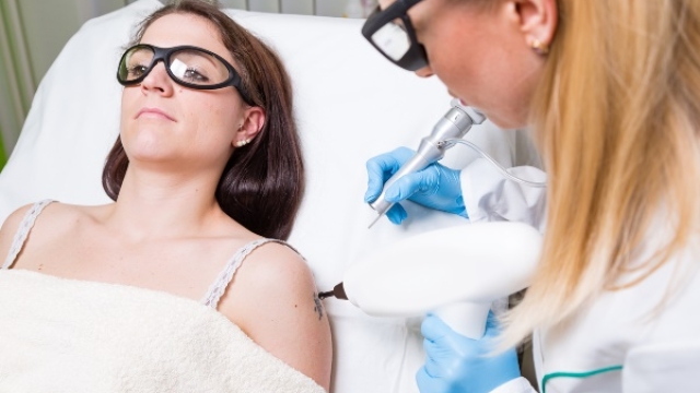 Tattoo Removal – What Methods Your Current