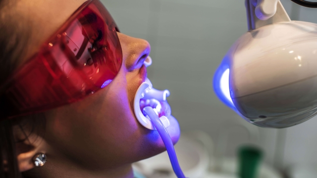 Sparkling Smiles: Unlocking the Secrets of Teeth Whitening