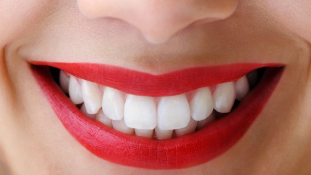 Sparkling Smiles: Unveiling the Best Teeth Whitening Products!